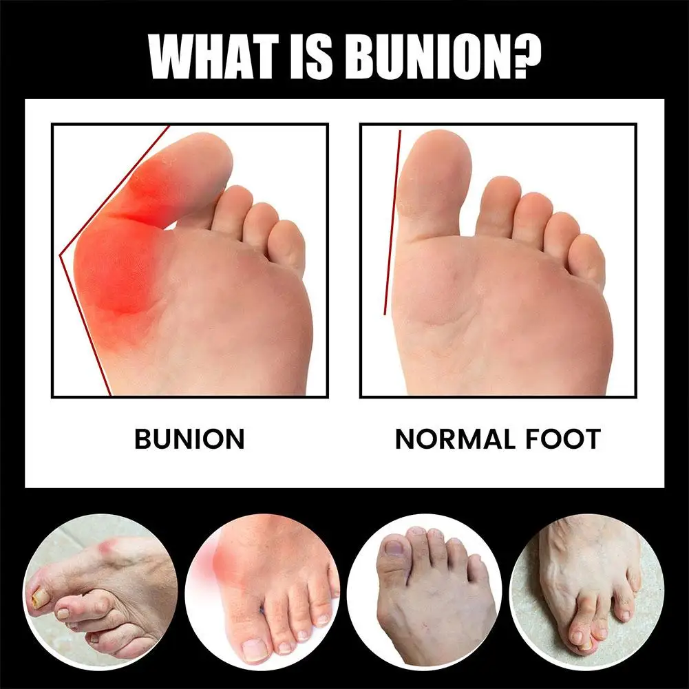 Unisex Anti-Bunions Health Sock Hallux Valgus Correcting Bunion Care Relief Breathable Aching Foot Sock V7Z8