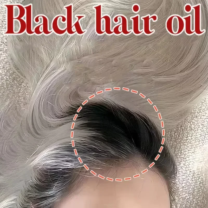 Natural Anti Gray Hair Serum-Repair White & Darkening Hair Nourishing Care Remedy anti gray hair serum