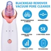 USB Rechargeable Blackhead Remover Vacuum Suction Pore Cleaner Extractor Acne Comedone Whitehead Pimple Removal Spot Cleaner 3