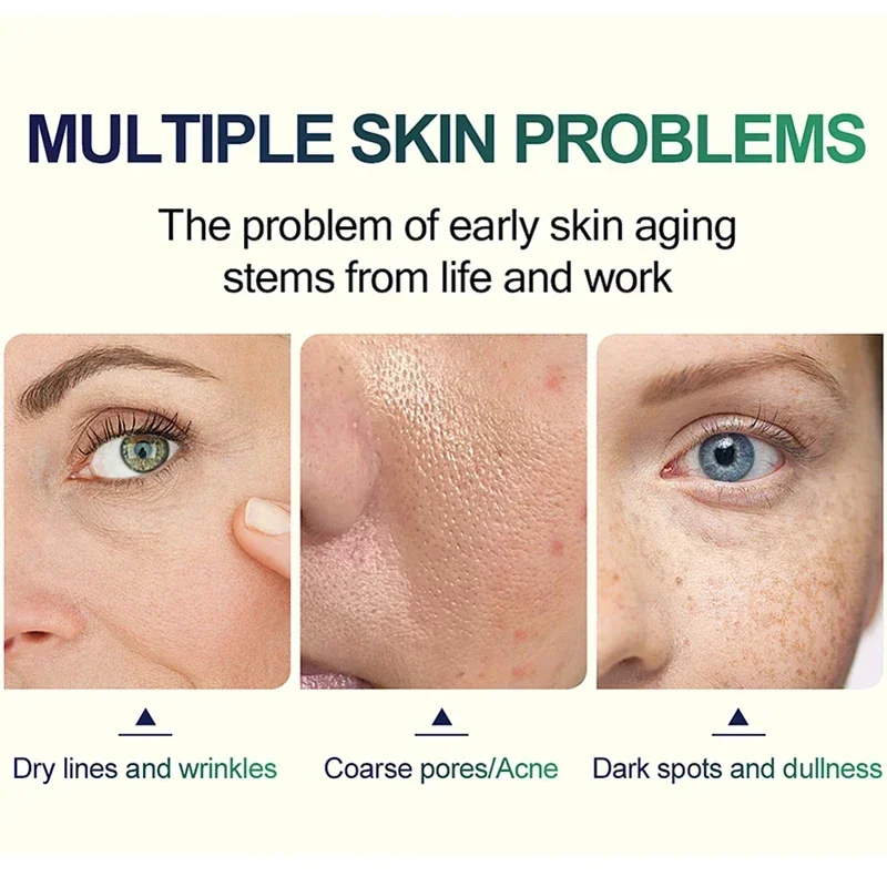 Facial peel kit Chemical Peel Tca Peel Acid 7-15 Days Delivered Skin Superforce Pigmentation Acne Scar Brightenhu skin care