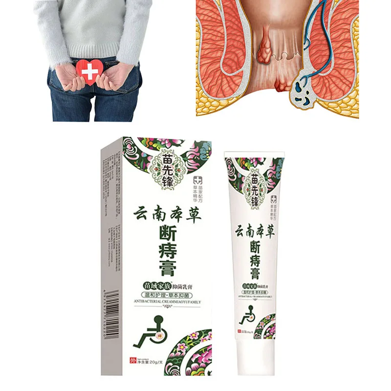 

20g Fissure Treatment Hemorrhoid Ointment Herbal Cream Natural Chinese Medicine Suppository Powerful Hemorrhoids Cream