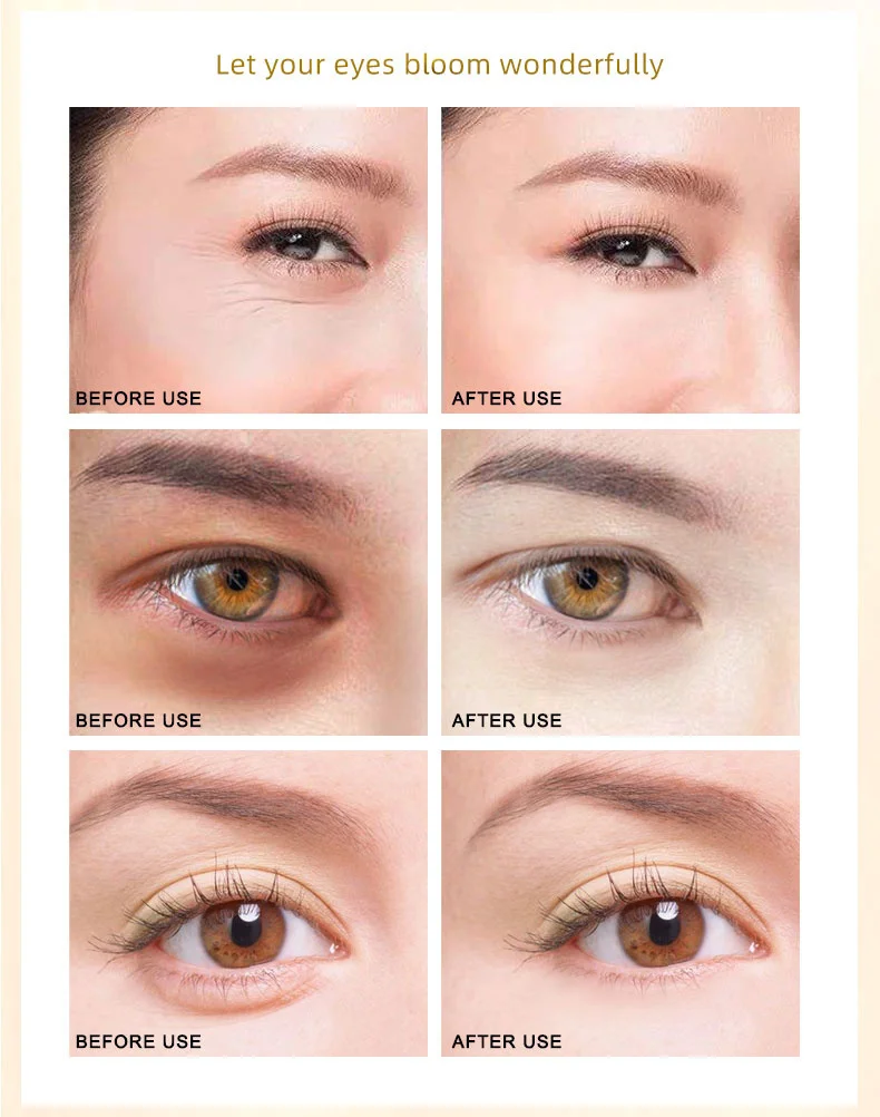Head - ARTISCARE PREMIUM Augenmaske 30 Paar - Hyaluronsäure | Gold | Algen | Schwarze Perle