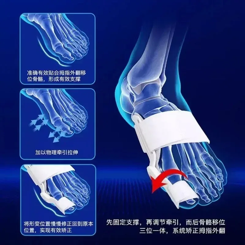 Bunion Splint Big Toe Straightener Corrector Foot Pain Relief Hallux Valgus Correction Orthopedic Supplies Pedicure Foot Care