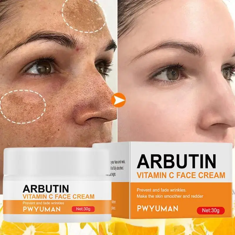 

Vitamin C Fade Dark Spot Face Cream Reduce Melanin Anti -Aging Rejuvenating Whitening Moisturize Skin Care Product Beauty-Health