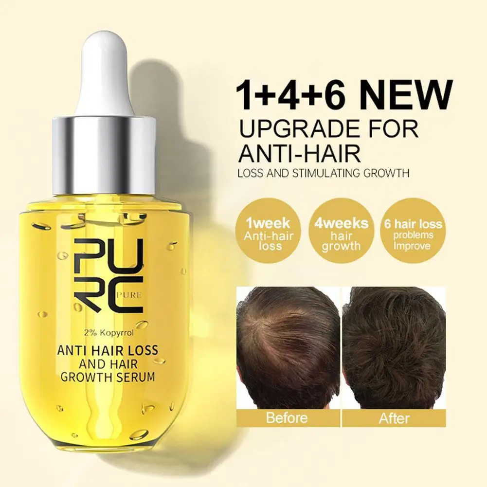 

PURC Products Ginger Serums Polygonum Multiflorum Hair Loss Treatment Hair Care Beauty Health For Men Women Q5T5