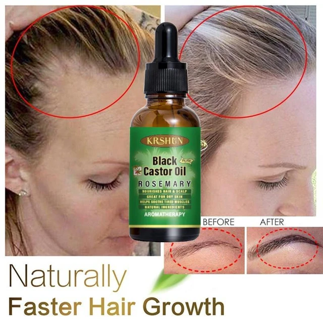 Castor Oil Eyebrows Men