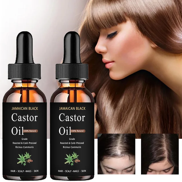 TRSTAY Jamaica Black Pure Natural Rizinusöl Haarbehandlung, feuchtigkeitsspendend, starke Kopfhautumgebung, gesunde Haarpflege