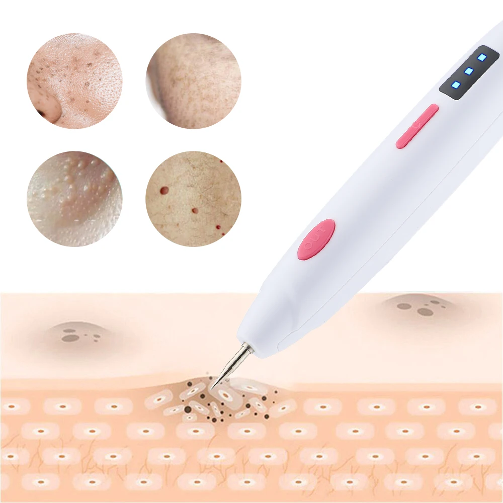 Facial beauty instrument laser plasma pen Electric laser plasma pen mini mole pen freckle black dot spots fat granules pimples tattoos warts skin tag removal beauty tools