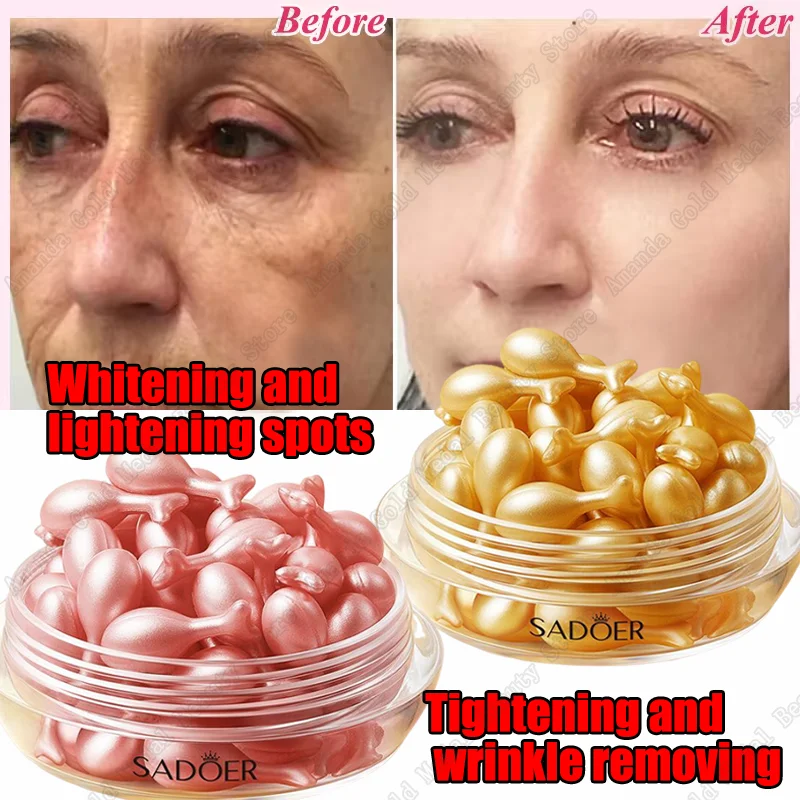facial serum freckle whitening serum black dots melasma remover anti brown stain lighten pigmentation moisturizing skin care Korean products