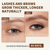 Organic Castor Oil Cold Pressed Massage Body Moisturizes Skin Nourish Hair Eyelash Nail Growth 16fl.oz Pure Natural Carrier Oil 5