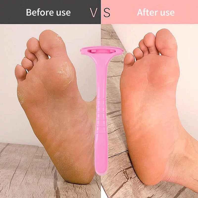 Professional Handle Dead Skin Calluses Removal Scraper Feet Care Nursing Plastic Portable Pedicure Massage Tool Beauty-health dead skin scraper
