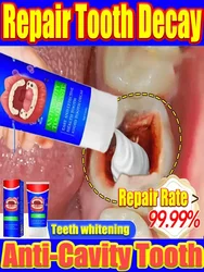Teeth Whitening Repair Tooth Decay Fresh Bad Breath Tooth Decay Anti-cavity Remove Plaque Toothache Relieve Periodontitis