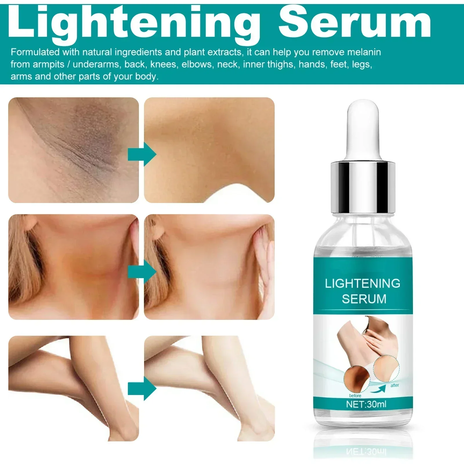 Skin Whitening Serum Private Parts Underarm Bleaching Serum Whiten Butt Knee Brighten Inner Thigh Arm Body Remove Dark Melanin 2