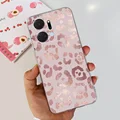 Case-U55