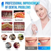 Electric Sonic Dental Scaler Calculus Remover Teeth Cleaner Dental Cleaning Teeth Whitening Toothbrush Tartar Remover Oral Care 2