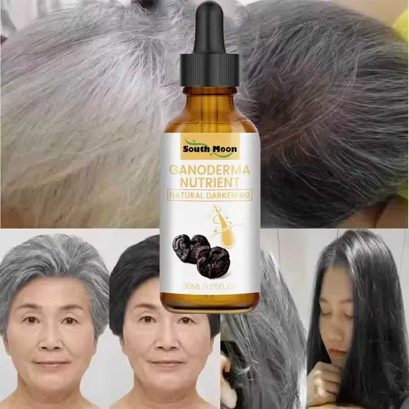 White Hair Killer Remove Gray Hair Restore Natural Hair Color In 7 days Effectively Repair Damaged Hair Maintain Hair Health New - Image 4