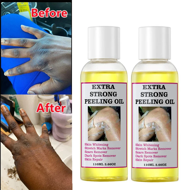 3PCS Peeling Oil For Dark Skin Super Strength Yellow Peeling Oil Strong