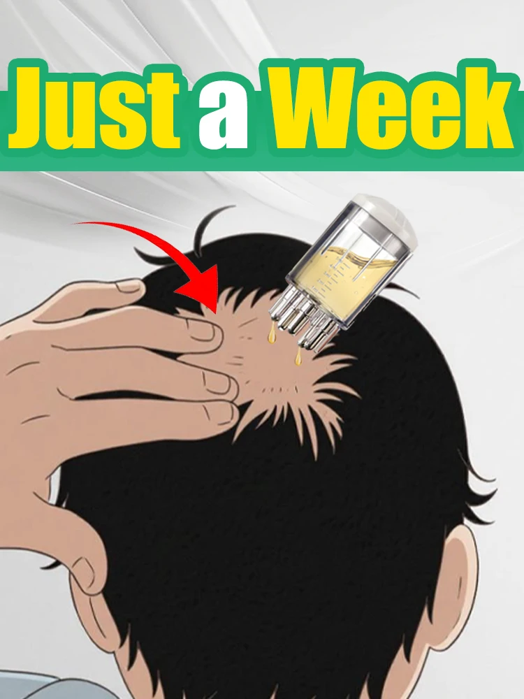 หวีทาเซรั่มบำรุงหนังศีรษะแบบใหม่ สำหรับการรักษาหนังศีรษะ, เครื่องนวดนำทางเซรั่ม, ใช้สำหรับทาเซรั่มบำรุงผมและน้ำมันเร่งการเจริญเติบโตของเส้นผม 1