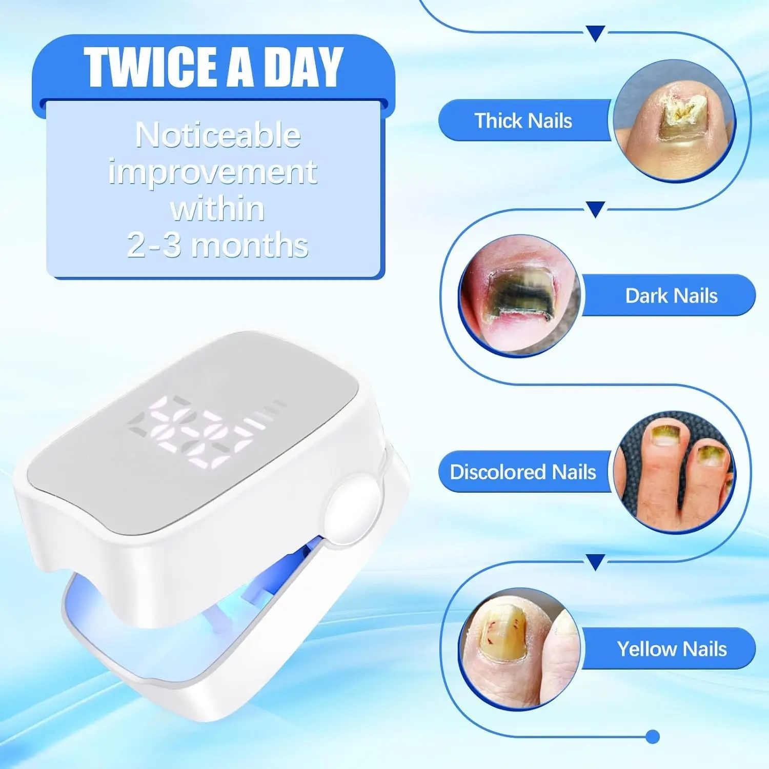 Nail Fungus Remover Personal Health Care Laser Therapy Pen Nail Fungus Laser Device with Time Display 470nm950nm wavelength for Finger/Toenails