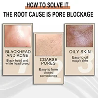 Pore Shrink Face Serum Essence