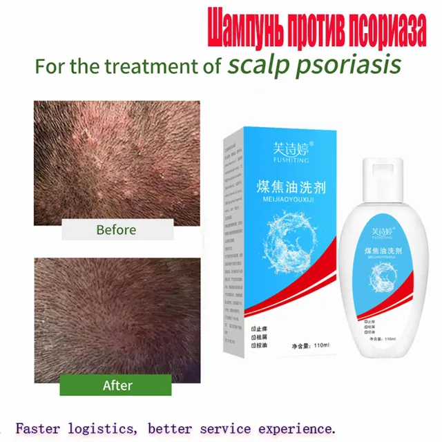 210ml Scalp Cleansing Shampoo Dandruff Seborrheic Follicles