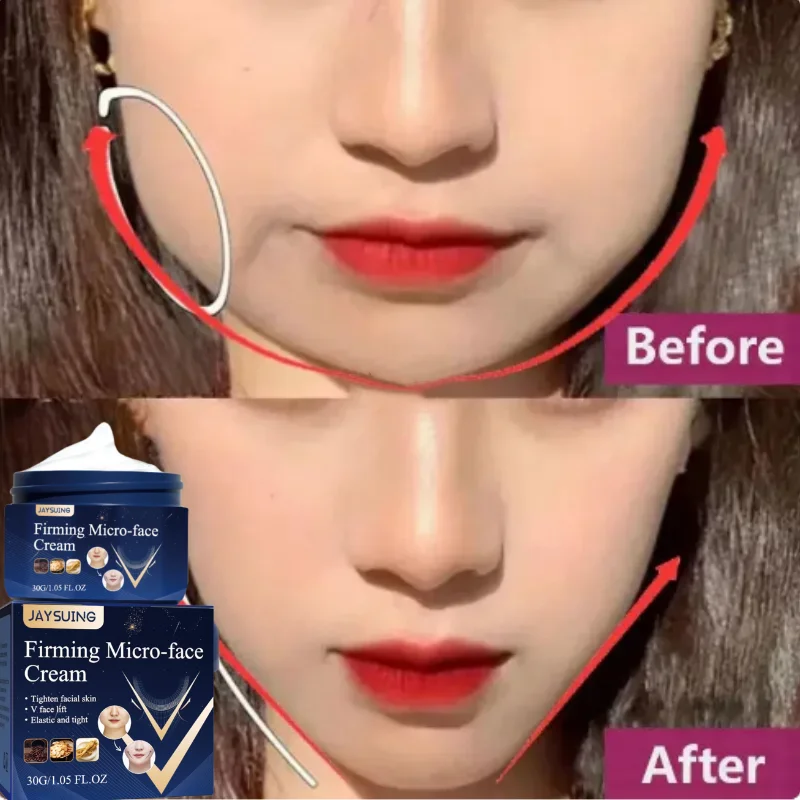V-Shape Firming Face-lift Slimming Cream Remove Chewy Muscles Double Chin Face Cellulite Fat Burn Anti-Wrinkle Lift Skin Care