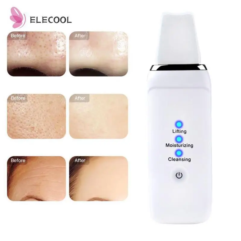 

Ультразвуковой очиститель черных точек, акне, очиститель пор, средство для удаления черных точек, электрическая шпатель для чистки кожи лица Массажер для лифтинга