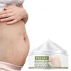 Pregnant Women's Belly Line Cream For Preventing Postpartum Pregnancy Lines Repair Cream 5