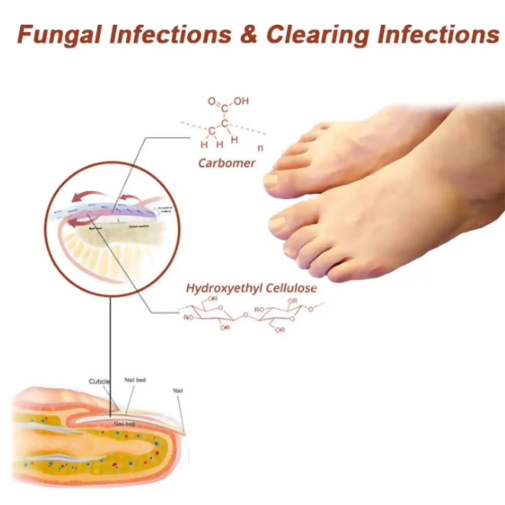Nail Laser Fungal Nail Device Fast Repair Nails Fungus Onychomycosis Toenail Fingernail Cleaning Nail Fungus Relief Device Foot Care