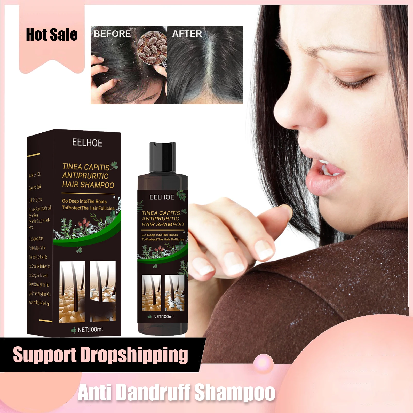 

Anti Dandruff Shampoo Tinea Capitis Antipruritic Shampoo Treatment Itching Flaking Scalp Psoriasis Repair Dermatitis Hair Care