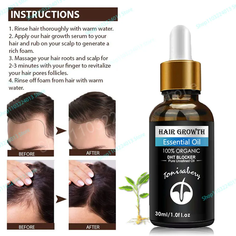 

Hair growth oil, rapid hair growth, effective baldness repair, hereditary hair loss, postpartum hair loss, seborrheic alopecia