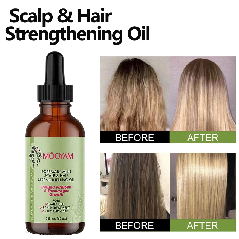 Rosemary Mint Scalp Hair Strengthening Oil With Biotin Essential Oils Nourishing Treatment for Split Ends and Dry Scalp