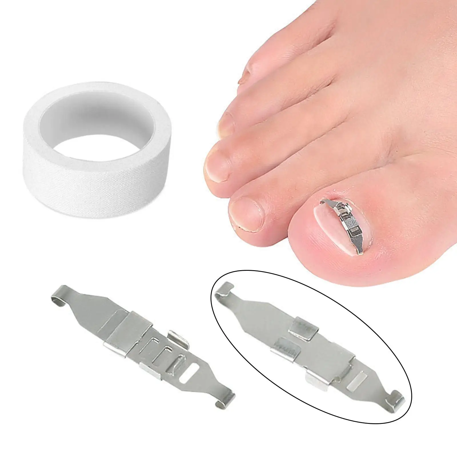 Cat Ingrown Nail Removal