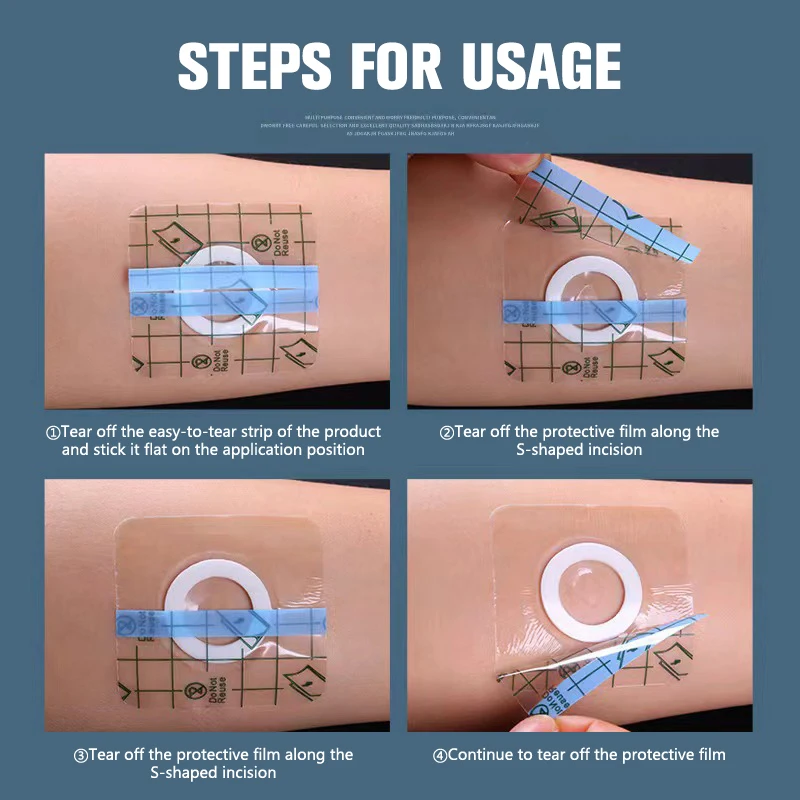10pc Transparent Tape Medical PU Film Adhesive Plaster Waterproof Anti-allergic Medicinal Wound Dressing Fixation Tape With Ring