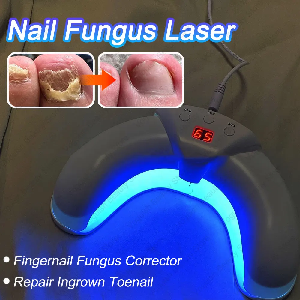 

Лазерное устройство для лечения грибка ногтей Восстанавливающее Средство Для вросших ногтей Корректор грибка для ногтей Podiatry Лазерная Форма для ногтей с грибами