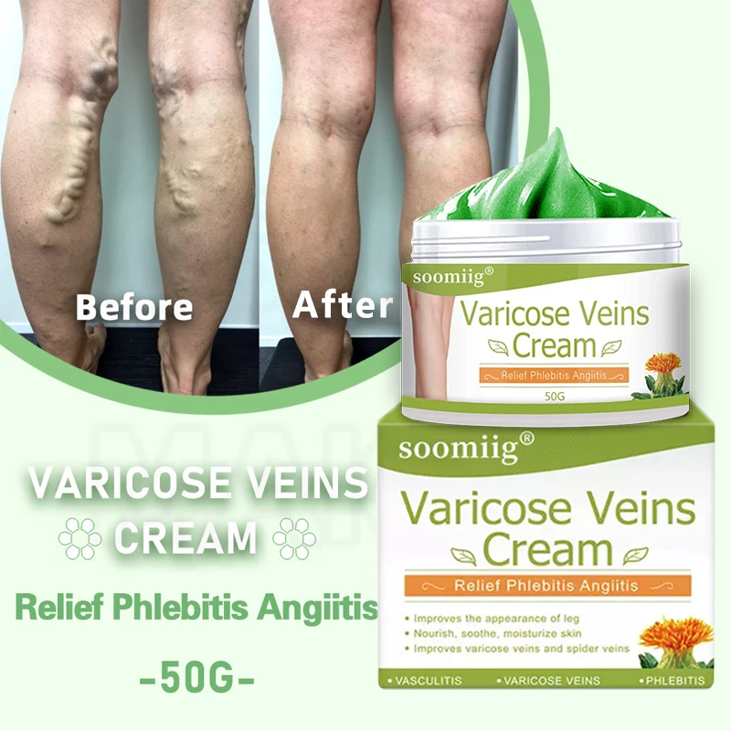 Рисунок 5 - Мазь для восстановления варикозного