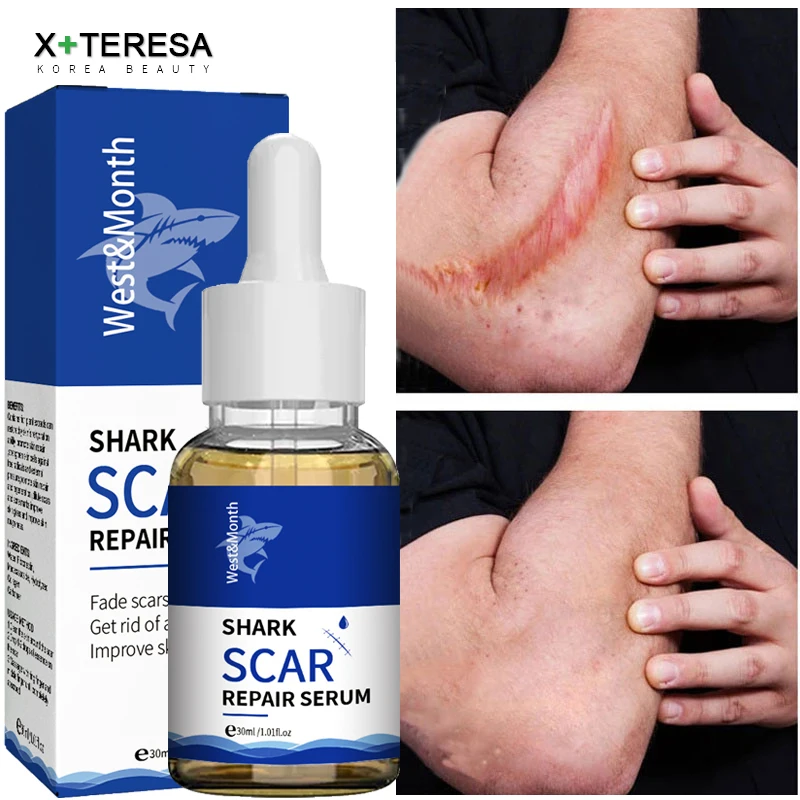 Scar Removal Serum Shark Stretch Marks Burn Surgical Scar Repair Essence Remove Acne Spots