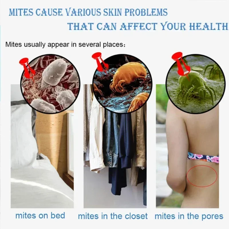 Body Wash 320ml Sulfur Liquid Mite Removal Soap Shower Gel Deep Cleansing Body Cleansers Whole Body Acne Wash