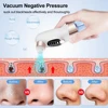 Electric Vacuum Blackhead Remover Bubble Water Cycle Face Dead Skin Acne Pore Cleansing Suction Blackheads Removal Instrument 3