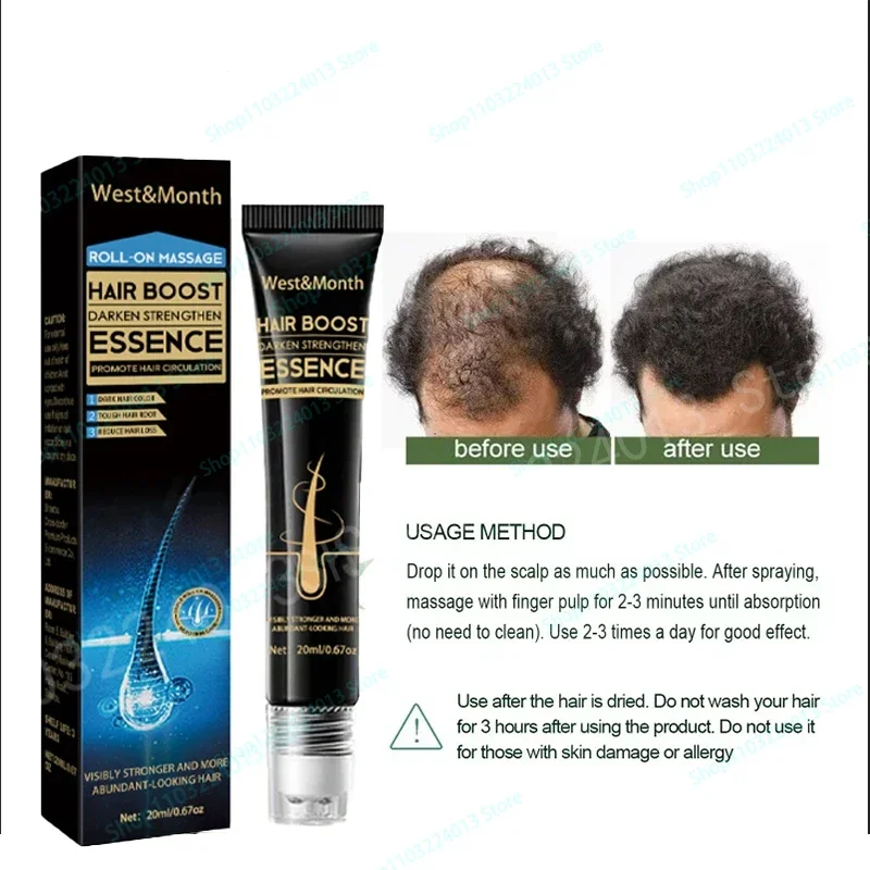 

Hair Growth Spray Strengthening-Hair Massage Scalp Dense-Hair Strengthening Hair Loss Prevention Repair Nourishing Liquid