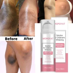Armpit Whitening Cream Skin Lightening Bleaching For Underarm Dark Legs Knees Intimate Body Care