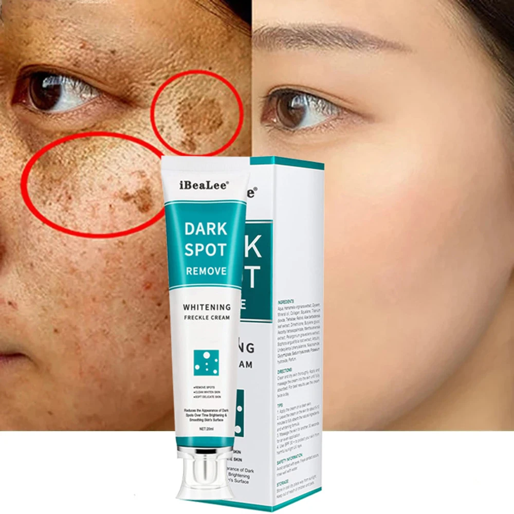 20ml Whitening Freckle Cream Face Moisturizing Remove Dark Spots Melanin Melasma Remover Brightening Skin Repair Anti-Aging Care face skin care whitening freckles cream remove melasma dark spots lighten remover moisturizing brightening 20ml