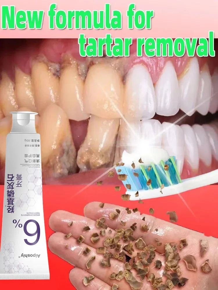 Dental Calculus Remover Teeth Whitening Product Mouth Odor Removal Bad Breath Preventing Periodontitis