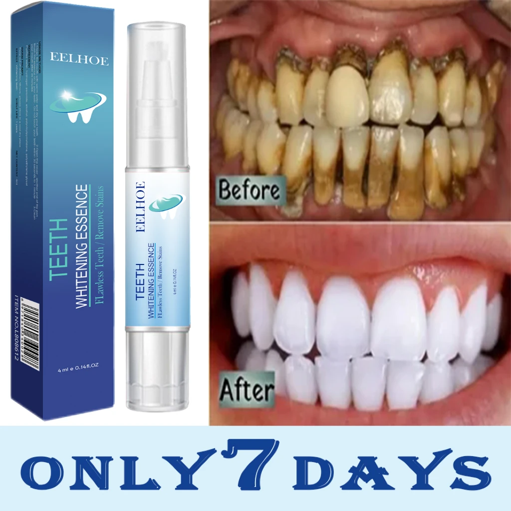 eelhoe-teeth-whitening-pen-easily-remove-gum-stains-instant-cleansing