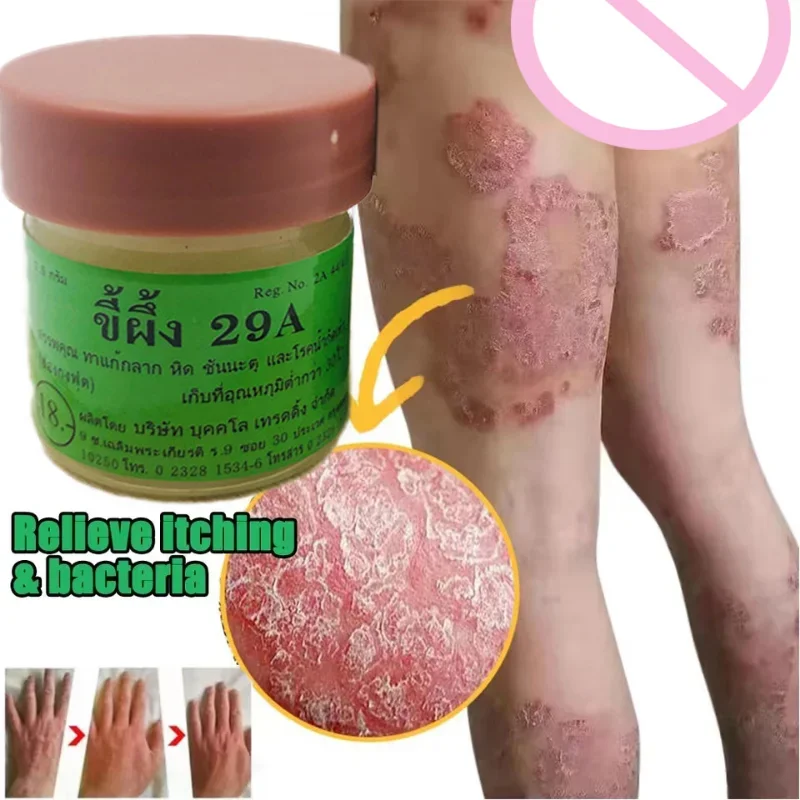 

Menthol Cooling Cream Thailand Psoriasis Cream Inhibits Skin Fungus Anti-itch Rash Eczema Dermatitis Beriberi Care Cream Product