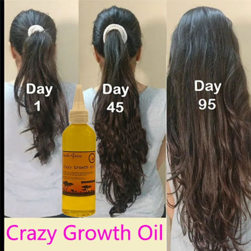 Africa Fast Hair Growth Oils The Secret To Get Thicker Longer Healthier Hair Rapid Hair Growth Stop Alopecia Remedy hair rapid growth spray anti hair loss hair growth spray essential oil liquid for men women hair regeneration repair hair loss