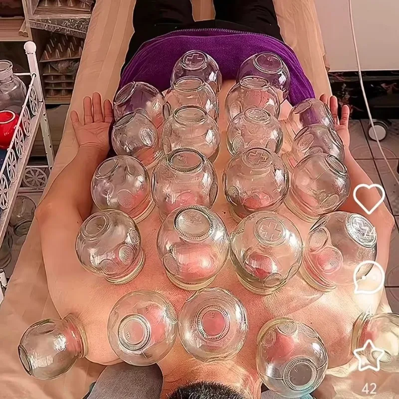 Ensemble de 6 ventouses de feu en verre pour thérapie Gua Sha, soins médicaux chinois, Instrument de ventouses sous vide, 6 tailles au choix 1