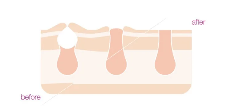 S9a57afb6e0e4426eb472a90fddf8a163Q