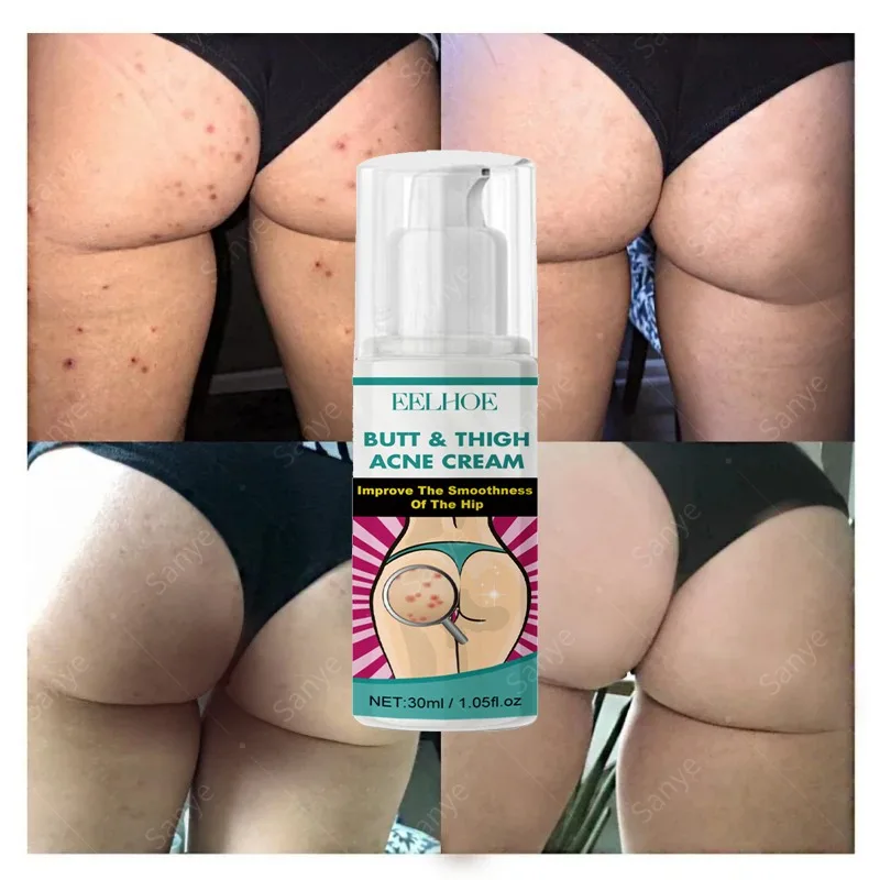Women Body Lightening Cream Brighten Dull Fade Pimples Moisturize Lotion Butt Inner Thigh Brightening Serum Buttock Smooth Cream whitening body cream whitening cream body lotion brightening cream whitening serum brightening body cream body skin care cream