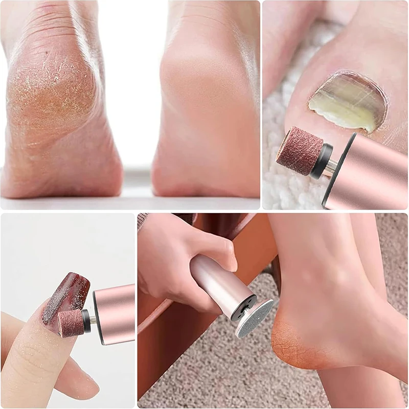 2 IN 1 Foot Care File Electric Foot Callus Remover Leg Heels Remove Dead Skin Pedicure Tool 4